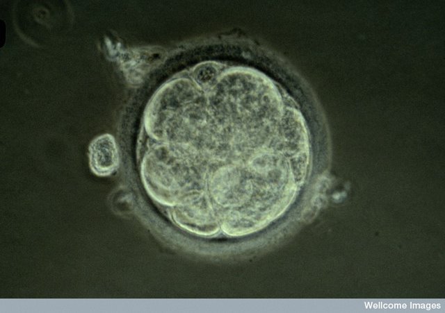 Manusia Berhasil Mendesain Embrionya